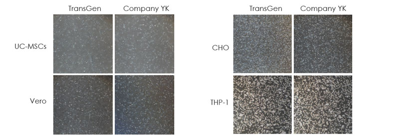 使用TransGen 冻存液和Company YK 无DMSO 无蛋白冻存液在-80℃冻存1 个月的多种细胞复苏24 小时后细胞贴壁情况的比较