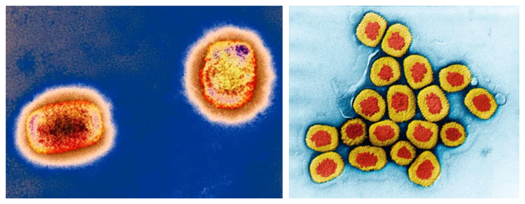  猴痘病毒颗粒，来源：英国《新科学家》杂志网站                 天花病毒颗粒，来源：中国《显微镜下的疾病与药物》